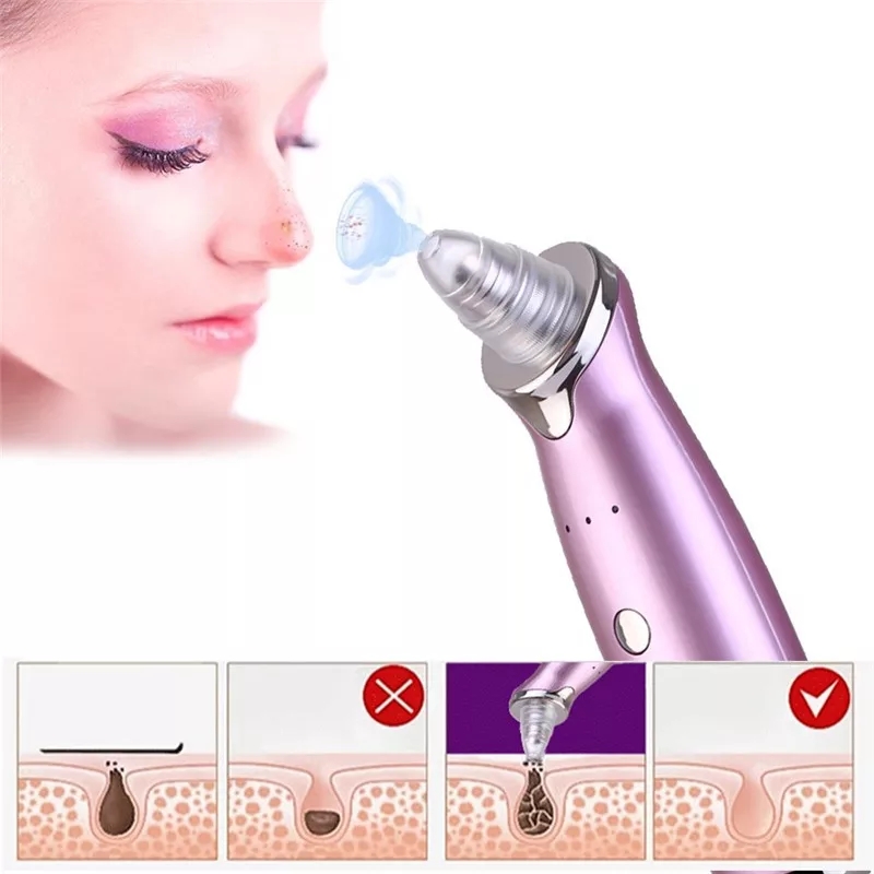 SkinSuction